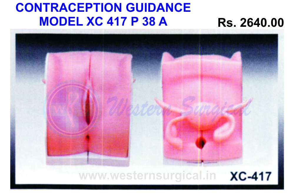 Contraception Guidance model 