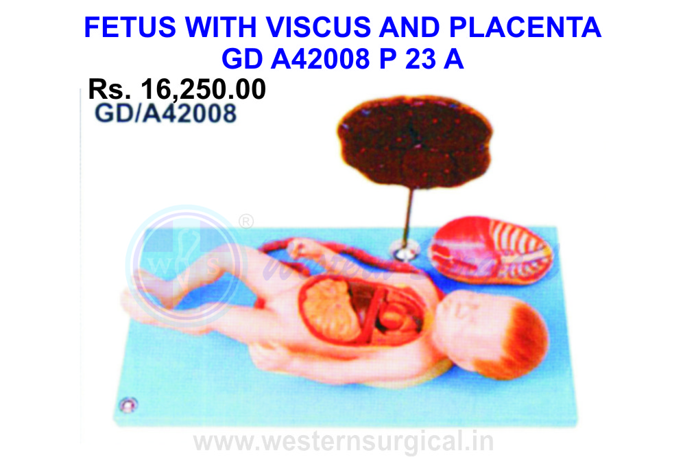 Fetus with Viscera and placenta