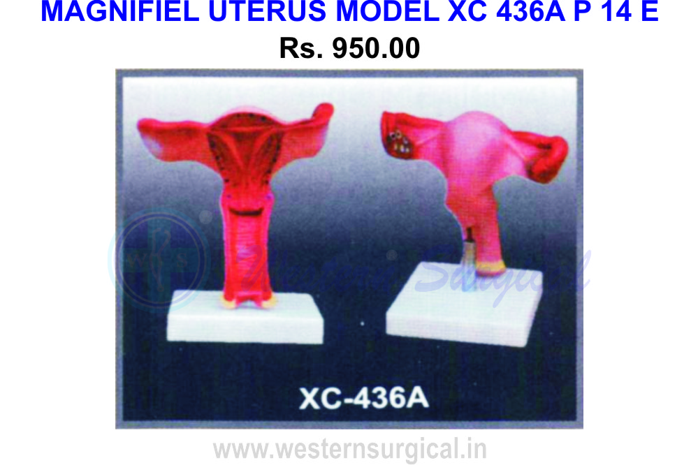 Magnified uterus model