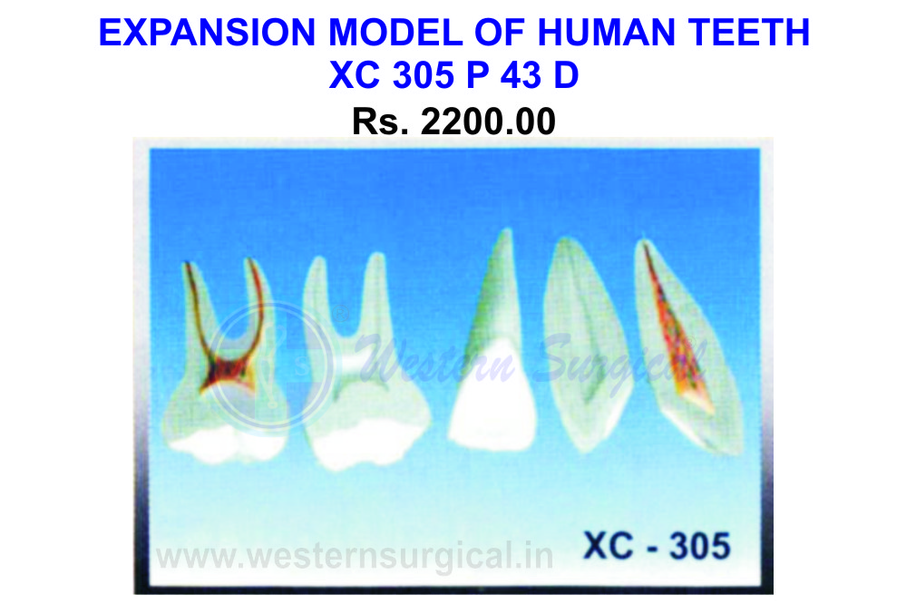 Expansion model of human teeth