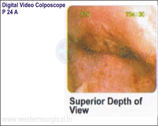 Digital Video Colposcope (Superior Depth Of View)