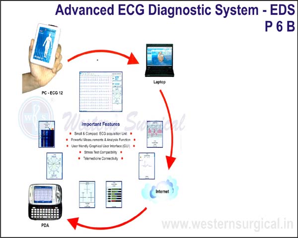 Advanced ECG diagnostic system